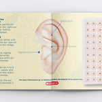 Ear Seed Acupuncture Kit